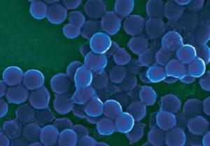 Biofilm